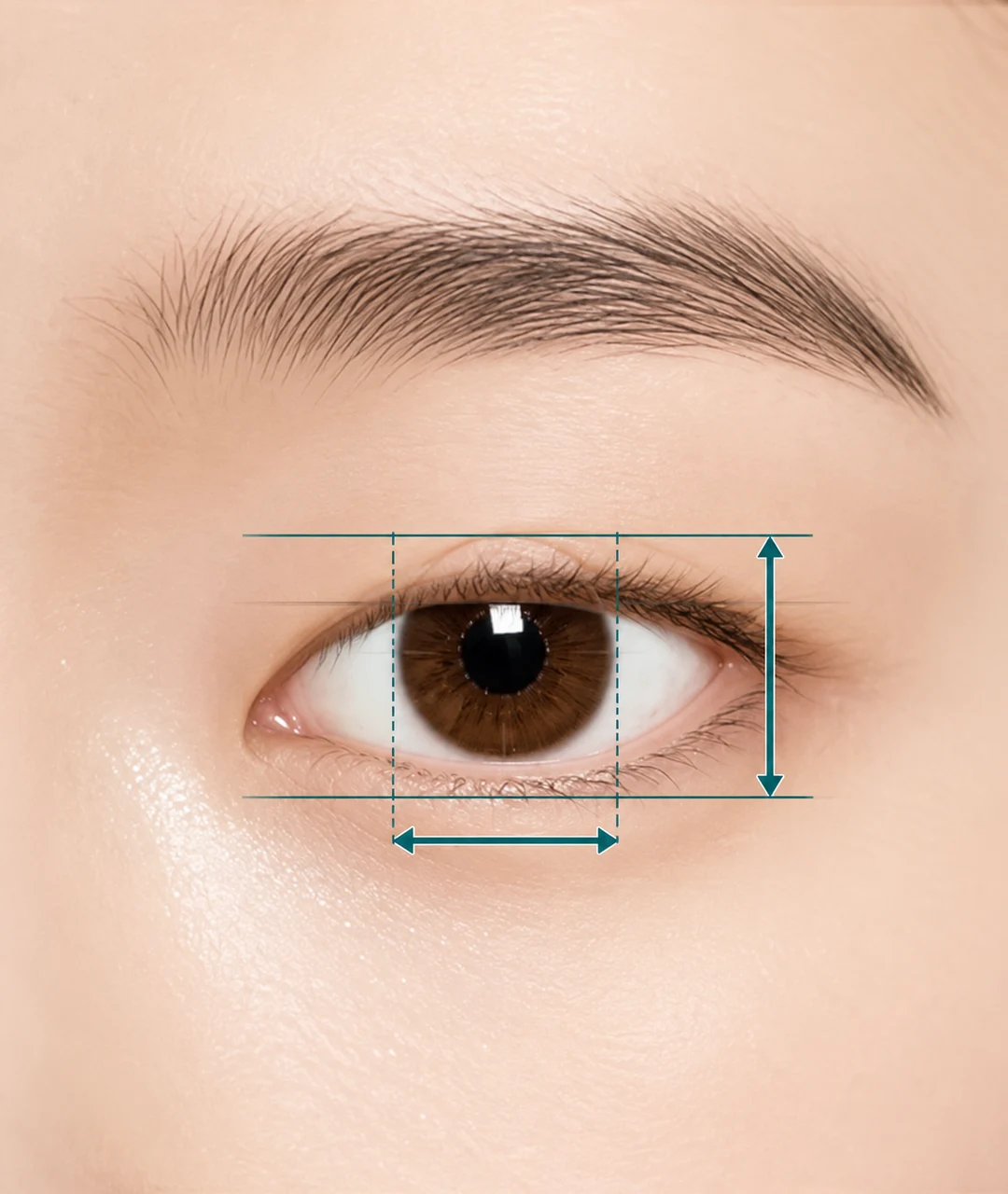 Upper eyelid position
