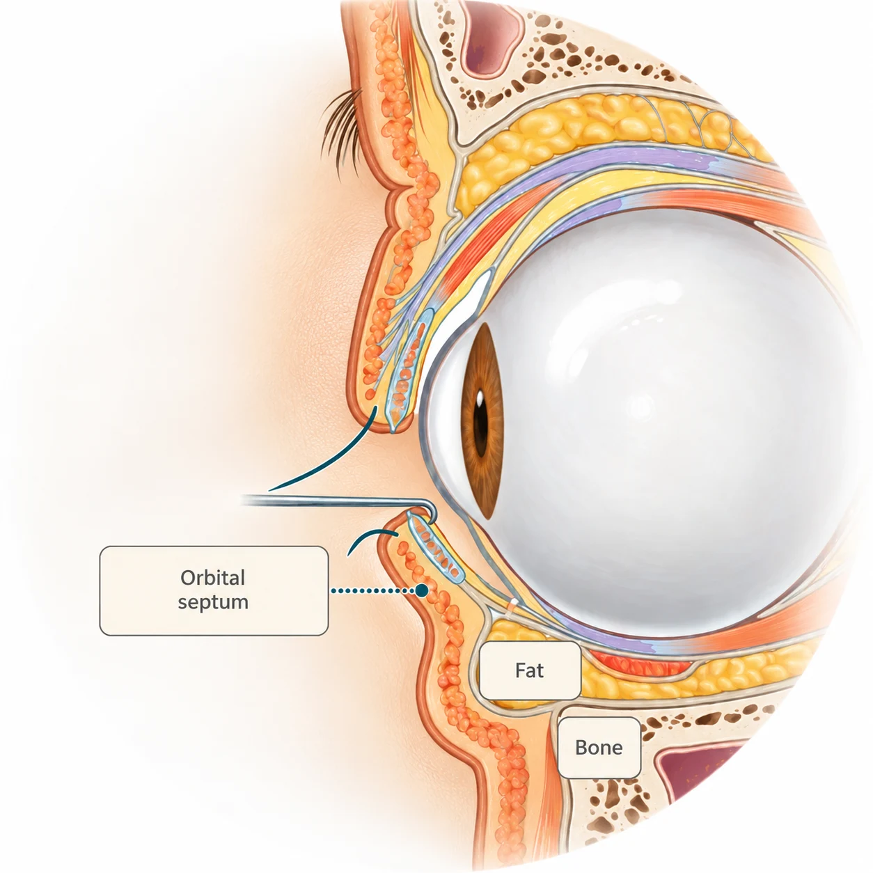 Orbital septum anatomy