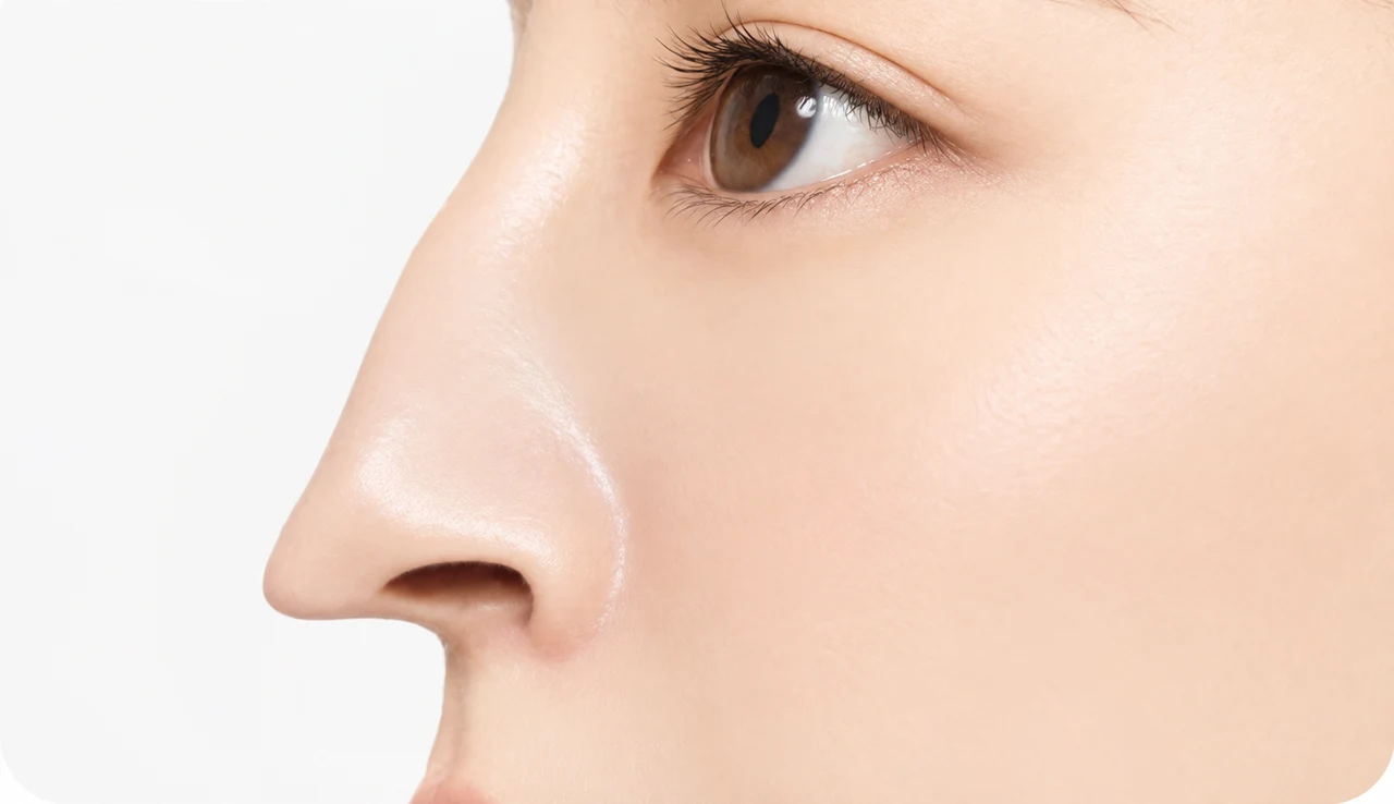 Downturned nasal tip