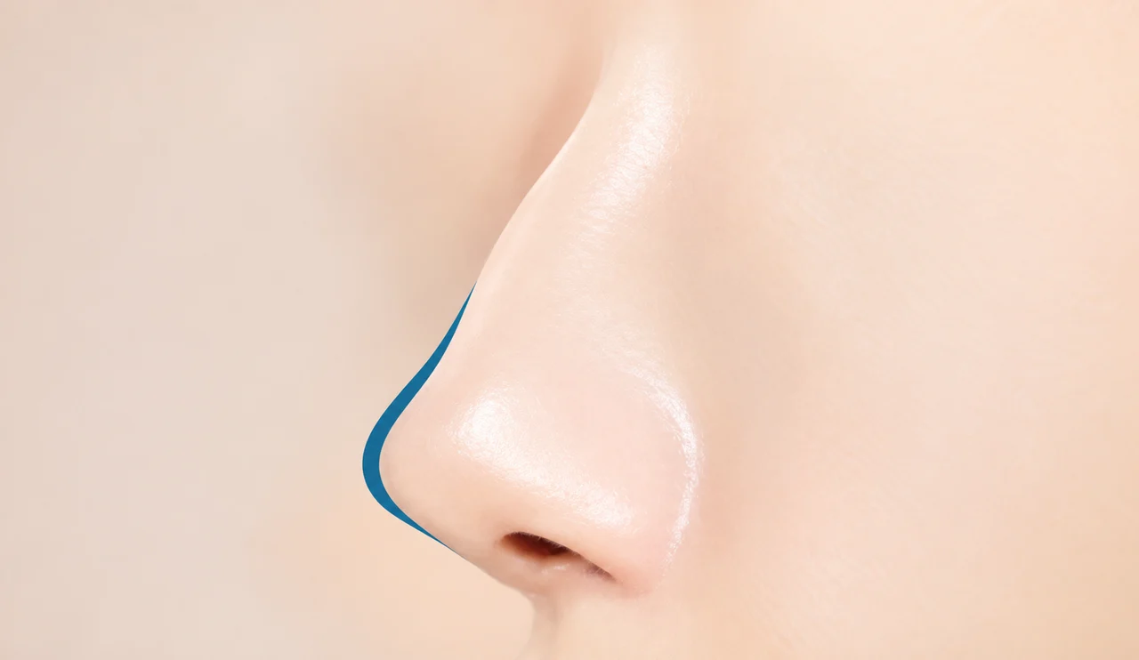 Tip contour
