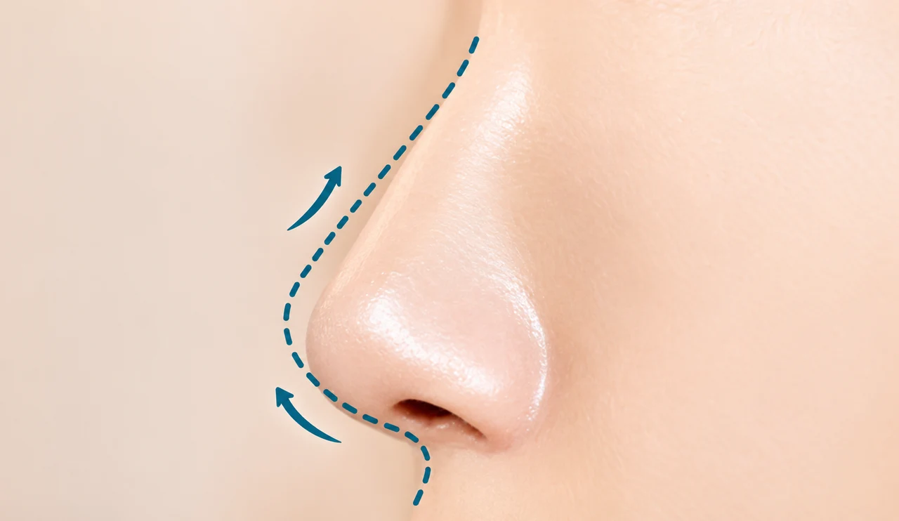 Bridge-to-tip continuity