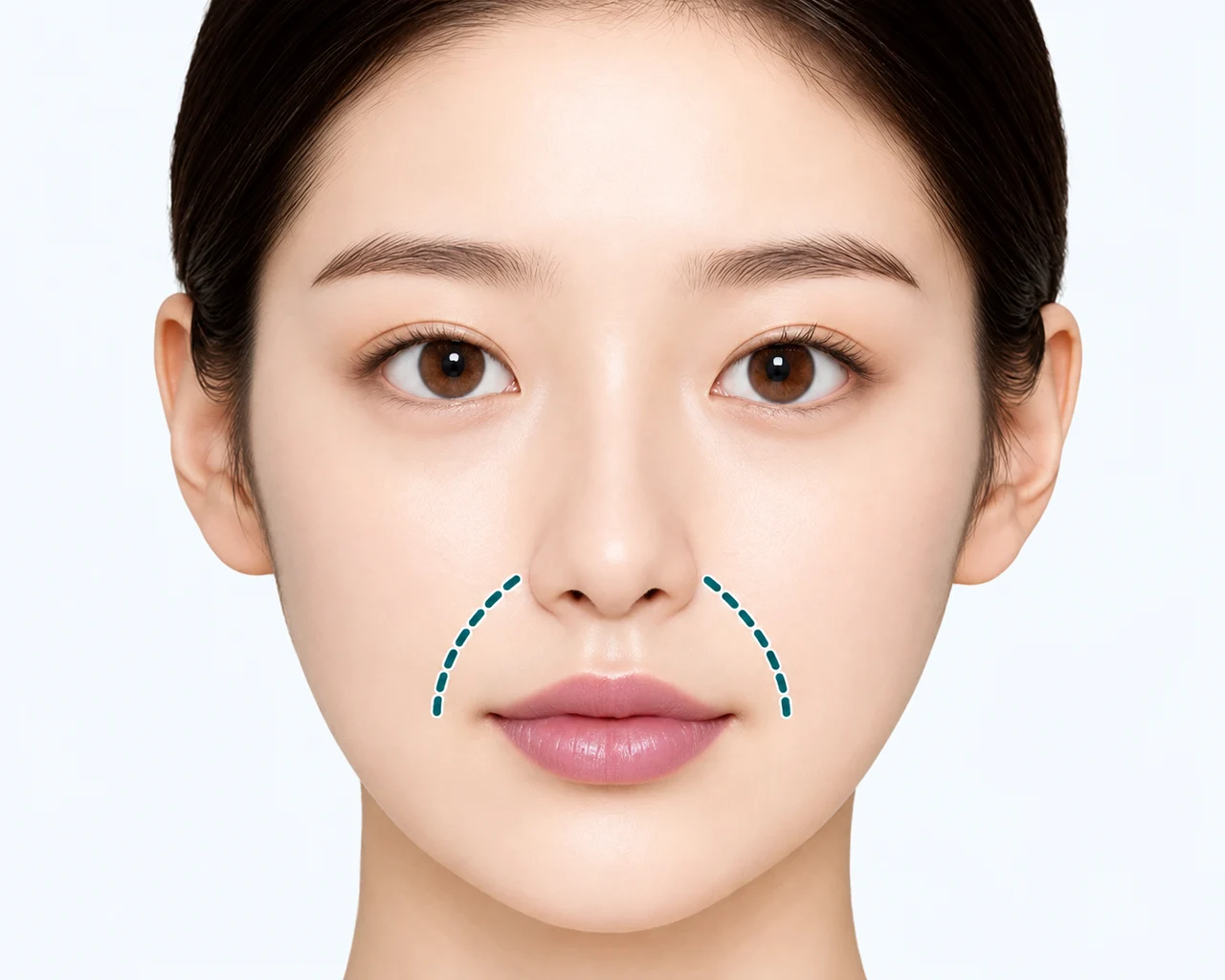 팔자주름이 깊어 보이는 경우 — 팔자 골이 깊어져 실제보다 더 나이 들어 보이는 경우