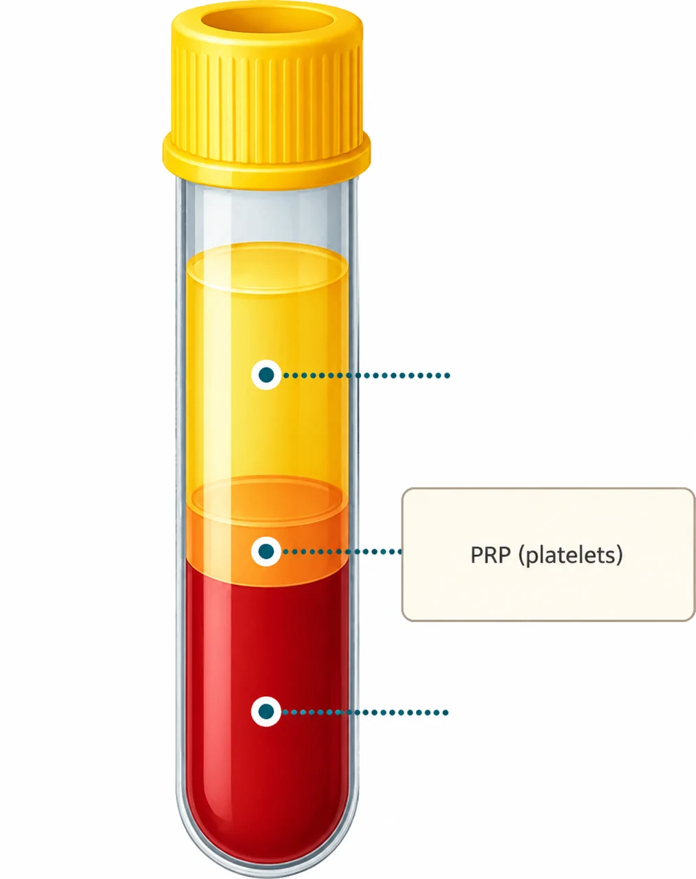 Blood component separation