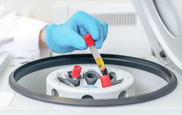 Centrifugal processing