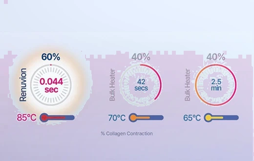 Energy delivery comparison