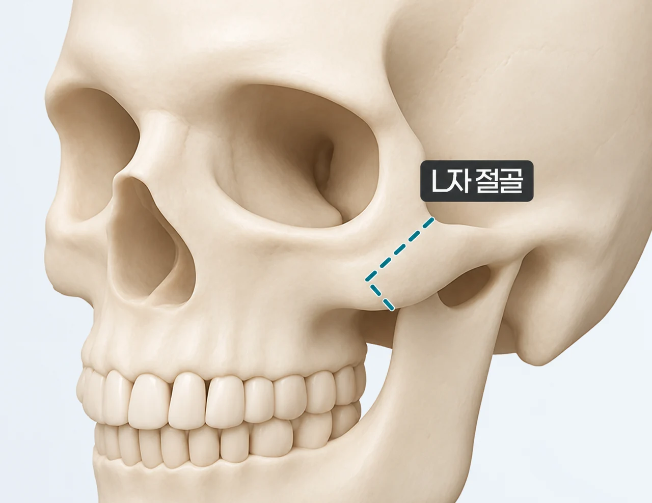 Lower cheekbone anatomy