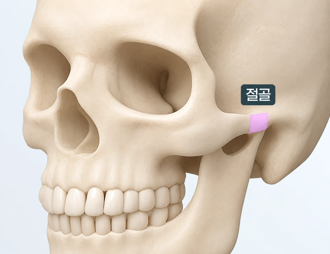 Anterior cheekbone anatomy