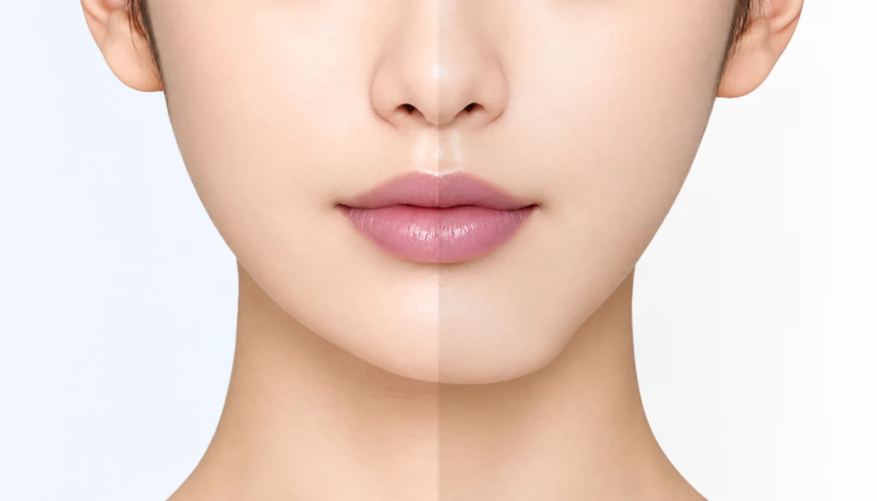 Frontal chin assessment