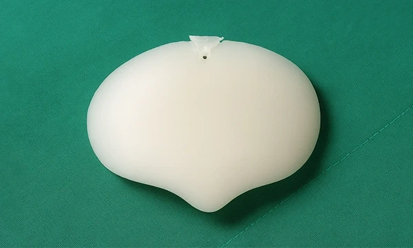 Custom forehead implant